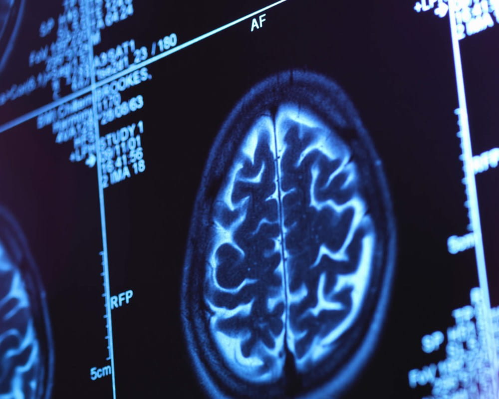 Cerveau